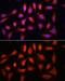 Interferon Regulatory Factor 1 antibody, GTX55681, GeneTex, Immunocytochemistry image 