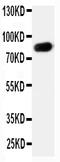 Reticulon-1 antibody, PA2255, Boster Biological Technology, Western Blot image 