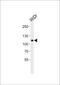 Caspase Recruitment Domain Family Member 6 antibody, PA5-72613, Invitrogen Antibodies, Western Blot image 