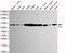 5-Aminoimidazole-4-Carboxamide Ribonucleotide Formyltransferase/IMP Cyclohydrolase antibody, M05404, Boster Biological Technology, Western Blot image 