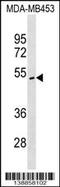 Inositol-tetrakisphosphate 1-kinase antibody, 60-219, ProSci, Western Blot image 