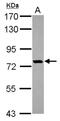 Oxysterol Binding Protein Like 10 antibody, NBP2-19636, Novus Biologicals, Western Blot image 