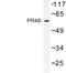 Protein Phosphatase 2 Regulatory Subunit B''Beta antibody, LS-C177492, Lifespan Biosciences, Western Blot image 