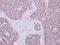 Insulin Receptor Substrate 1 antibody, PA5-29667, Invitrogen Antibodies, Immunohistochemistry frozen image 