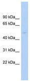 Thyroid Hormone Receptor Interactor 13 antibody, TA343448, Origene, Western Blot image 