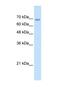 Transmembrane 9 Superfamily Member 1 antibody, NBP1-69486, Novus Biologicals, Western Blot image 