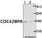 CDC42 Binding Protein Kinase Alpha antibody, A05509, Boster Biological Technology, Western Blot image 