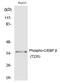 CCAAT Enhancer Binding Protein Beta antibody, PA5-40195, Invitrogen Antibodies, Western Blot image 