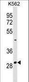 Nuclear Receptor Interacting Protein 2 antibody, LS-C158424, Lifespan Biosciences, Western Blot image 