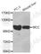 MCC Regulator Of WNT Signaling Pathway antibody, A7529, ABclonal Technology, Western Blot image 