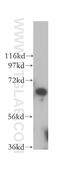 PiggyBac Transposable Element Derived 3 antibody, 17639-1-AP, Proteintech Group, Western Blot image 