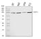 Transient Receptor Potential Cation Channel Subfamily V Member 1 antibody, A00128-4, Boster Biological Technology, Western Blot image 