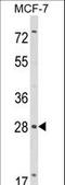 RAS Like Family 11 Member B antibody, LS-C162462, Lifespan Biosciences, Western Blot image 