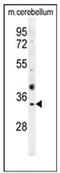 Olfactory Receptor Family 51 Subfamily I Member 1 antibody, AP53071PU-N, Origene, Western Blot image 
