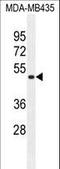 Transmembrane Anterior Posterior Transformation 1 antibody, LS-C161702, Lifespan Biosciences, Western Blot image 