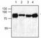 Hydroxyacyl-CoA Dehydrogenase Trifunctional Multienzyme Complex Subunit Alpha antibody, ab54477, Abcam, Western Blot image 