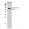 Cortactin antibody, LS-C387609, Lifespan Biosciences, Western Blot image 