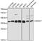 Exosome Component 7 antibody, GTX66579, GeneTex, Western Blot image 