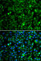 Trimethyllysine Hydroxylase, Epsilon antibody, STJ29451, St John