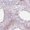 Sperm Associated Antigen 4 antibody, PA5-61732, Invitrogen Antibodies, Immunohistochemistry paraffin image 