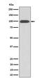 Integrin Subunit Beta 3 antibody, M00587-2, Boster Biological Technology, Western Blot image 
