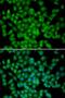 Cyclin Dependent Kinase Inhibitor 2C antibody, LS-C346057, Lifespan Biosciences, Immunofluorescence image 