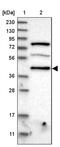 Programmed Cell Death 2 antibody, PA5-55388, Invitrogen Antibodies, Western Blot image 