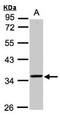 TRNA Methyltransferase 10B antibody, NBP1-32516, Novus Biologicals, Western Blot image 