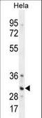 TNFRSF1A Associated Via Death Domain antibody, LS-C160154, Lifespan Biosciences, Western Blot image 