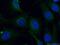 Ubiquitin Conjugating Enzyme E2 F (Putative) antibody, 17056-1-AP, Proteintech Group, Immunofluorescence image 