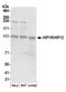 Huntingtin Interacting Protein 1 Related antibody, A304-805A, Bethyl Labs, Western Blot image 