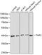 Twinfilin Actin Binding Protein 2 antibody, 15-123, ProSci, Western Blot image 