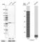 Core 1 Synthase, Glycoprotein-N-Acetylgalactosamine 3-Beta-Galactosyltransferase 1 antibody, PA5-52814, Invitrogen Antibodies, Western Blot image 