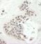 Kinesin Family Member 14 antibody, IHC-00475, Bethyl Labs, Immunohistochemistry paraffin image 
