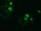 Zinc Finger Imprinted 2 antibody, GTX83403, GeneTex, Immunocytochemistry image 
