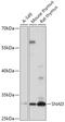 Snail Family Transcriptional Repressor 3 antibody, 18-135, ProSci, Western Blot image 