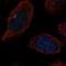 Beta-1,4-Galactosyltransferase 2 antibody, NBP2-58906, Novus Biologicals, Immunofluorescence image 