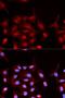 ABL Proto-Oncogene 1, Non-Receptor Tyrosine Kinase antibody, LS-C335713, Lifespan Biosciences, Immunofluorescence image 