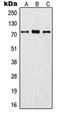 Inter-Alpha-Trypsin Inhibitor Heavy Chain 1 antibody, orb214128, Biorbyt, Western Blot image 