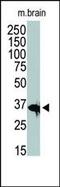 Histone Deacetylase 11 antibody, PA5-11250, Invitrogen Antibodies, Western Blot image 