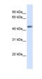 Sorting Nexin 5 antibody, orb330798, Biorbyt, Western Blot image 