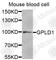 Glycosylphosphatidylinositol Specific Phospholipase D1 antibody, A6612, ABclonal Technology, Western Blot image 