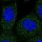 Ankyrin Repeat Domain 27 antibody, NBP1-85111, Novus Biologicals, Immunocytochemistry image 