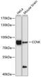 Cyclin K antibody, 13-542, ProSci, Western Blot image 