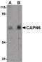 Calpain 6 antibody, PA5-20592, Invitrogen Antibodies, Western Blot image 