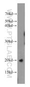 Tubulin Polymerization Promoting Protein Family Member 3 antibody, 15057-1-AP, Proteintech Group, Western Blot image 