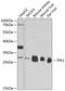 Thiamin Pyrophosphokinase 1 antibody, GTX66448, GeneTex, Western Blot image 