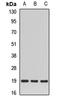 SCAN Domain Containing 1 antibody, LS-C668771, Lifespan Biosciences, Western Blot image 