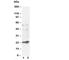 Glutathione S-Transferase Pi 1 antibody, R30217, NSJ Bioreagents, Western Blot image 