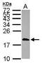 Calmodulin Like 3 antibody, PA5-30232, Invitrogen Antibodies, Western Blot image 